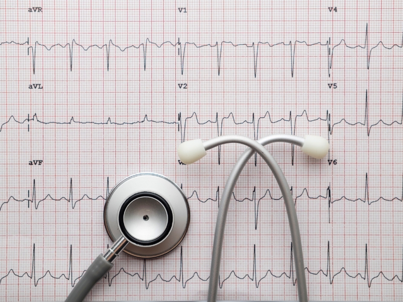 onde fazer endoscopia em Lauro de Freitas e holter