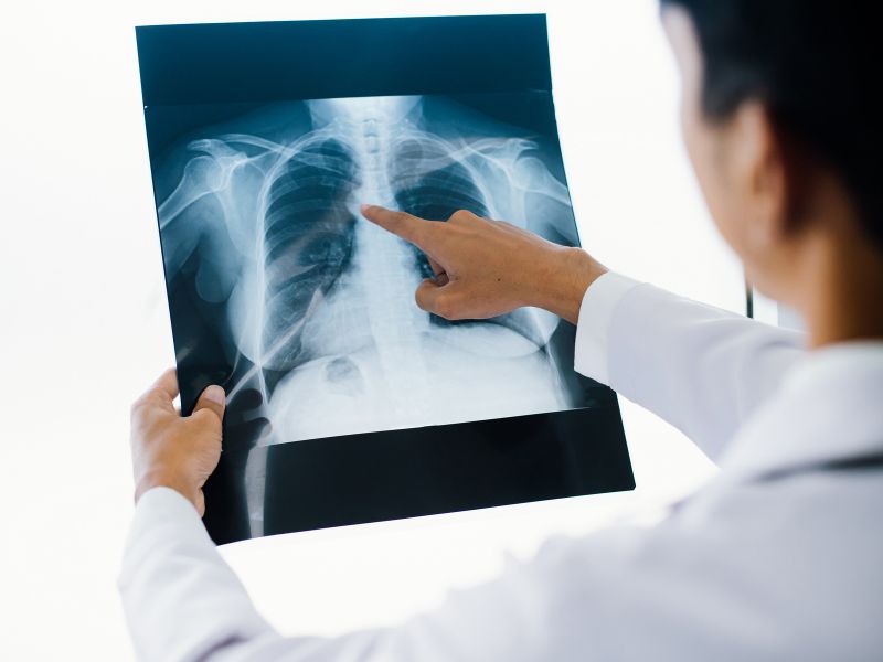 quanto custa consulta com pneumologista - doenças